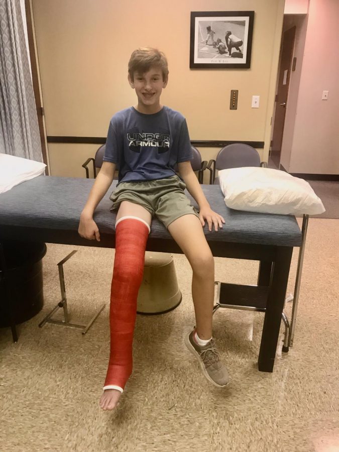 Jack Baldwin, a sophomore, sustained his first injury in September 2017. He wore the cast for 15 weeks. Despite his best efforts, he has struggled to remain injury-free since the initial football injury. 